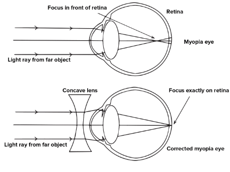 NCERT Exemplar: The Human Eye & the Colourful World | Science Class 10