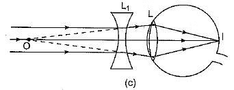 Correction by concave lens&nbsp;