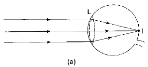 Class 10 Science Chapter 10 Previous Year Questions - The Human Eye and the Colourful World