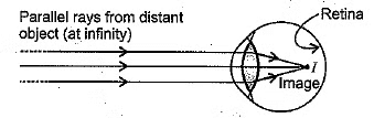 Class 10 Science Chapter 10 Previous Year Questions - The Human Eye and the Colourful World