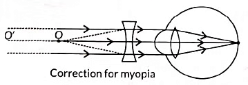 Class 10 Science Chapter 10 Previous Year Questions - The Human Eye and the Colourful World