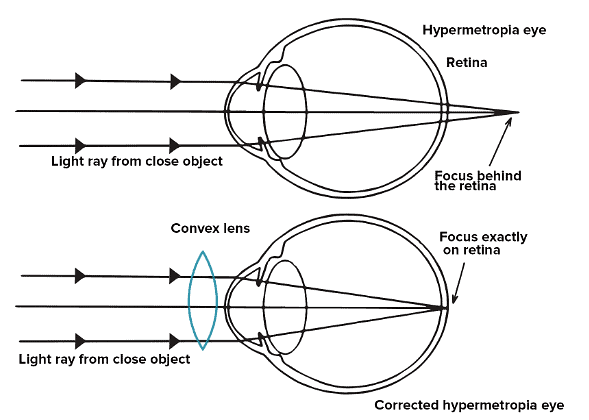 NCERT Exemplar: The Human Eye & the Colourful World | Science Class 10