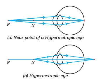 Diagram Based Questions: The Human Eye and the Colourful World | Science Class 10