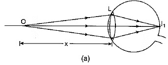 Class 10 Science Chapter 10 Previous Year Questions - The Human Eye and the Colourful World