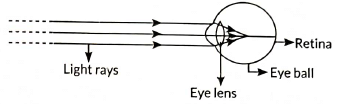 Class 10 Science Chapter 10 Previous Year Questions - The Human Eye and the Colourful World