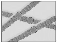 Class 8 Science - Question Answers Microorganisms Friend or Foe- 1