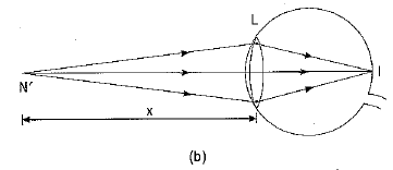 Class 10 Science Chapter 10 Previous Year Questions - The Human Eye and the Colourful World