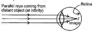 Class 10 Science Chapter 10 Previous Year Questions - The Human Eye and the Colourful World