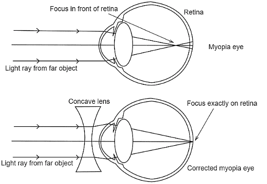 NCERT Exemplar: The Human Eye & the Colourful World | Science Class 10
