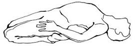 Yoga as Preventive Measure for Lifestyle Disease - 1 Chapter Notes | Physical Education Class 11 (XI) - CBSE and NCERT Curriculum