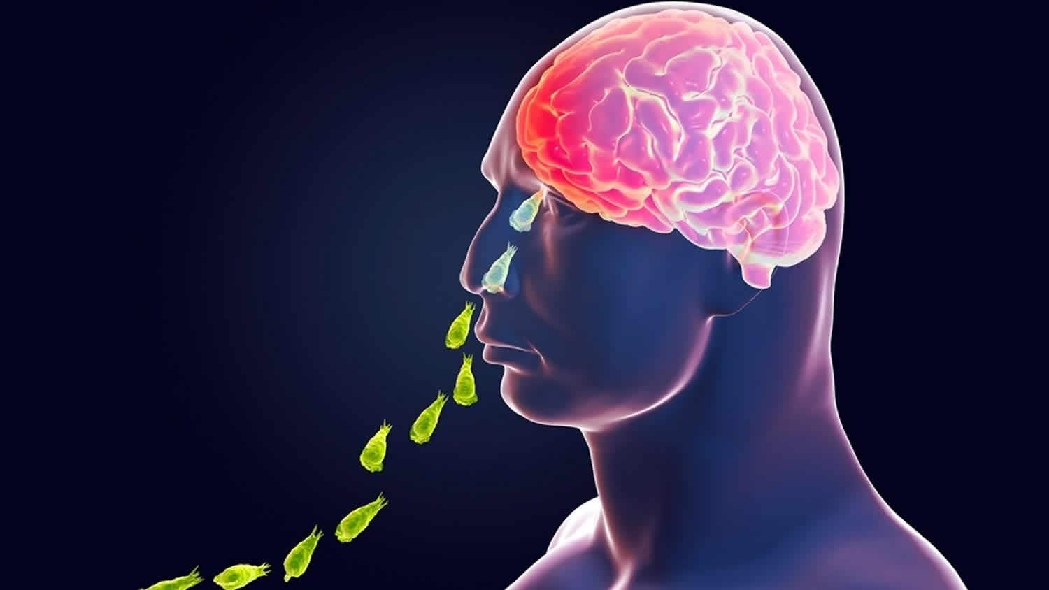Primary Amoebic Meningoencephalitis (PAM)