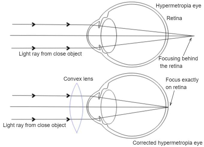Class 10 Science Chapter 10 Previous Year Questions - The Human Eye and the Colourful World