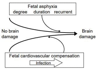 Relationship of fetal asphyxia to brain damage