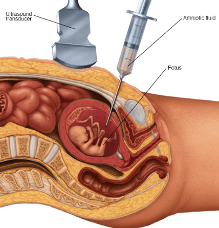 NCERT Solutions Class 12 Biology Chapter 3 - Reproductive Health
