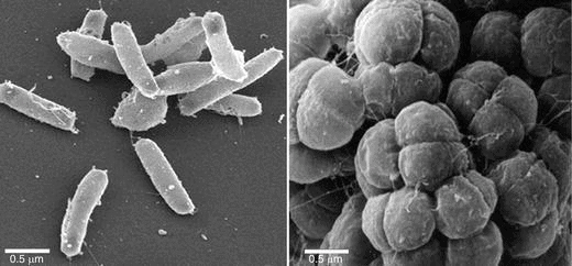 Halophiles- Halobacterium