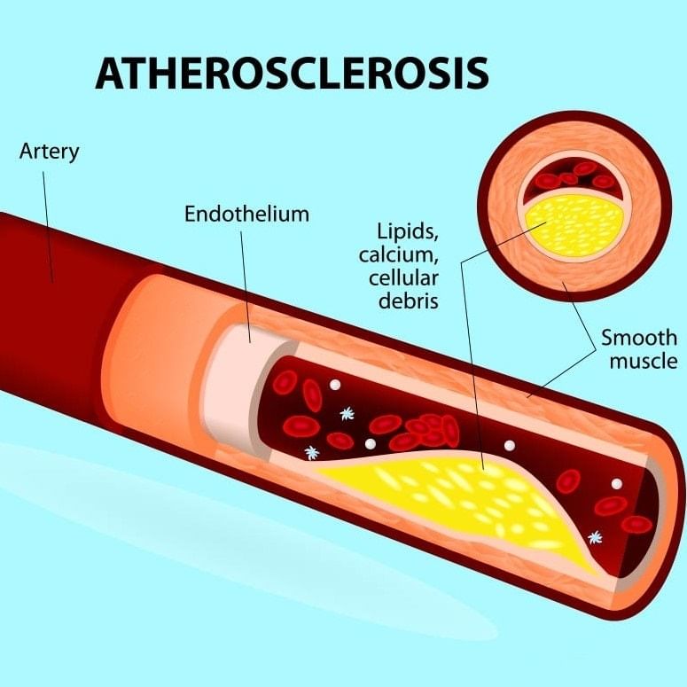 Double Circulation & Disorders of Circulatory System | Biology Class 11 - NEET