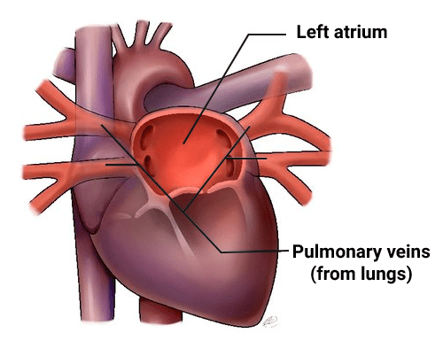 Veins carry deoxygenated blood except for the Pulmonary Vein