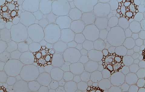 Parenchyma