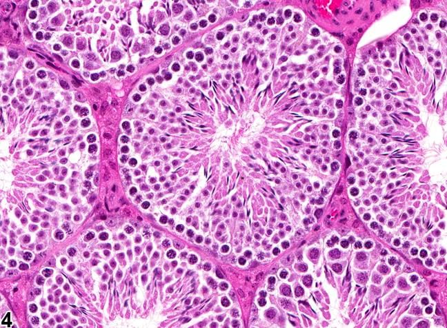 Seminiferous tubule