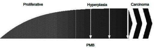 Premature Ovarian Failure