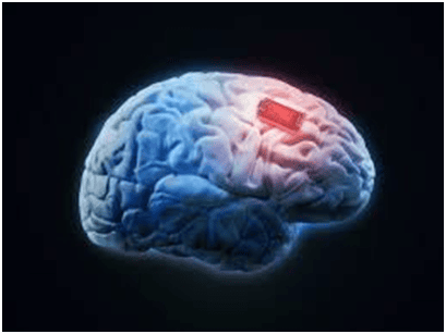 Nano-MIND Technology