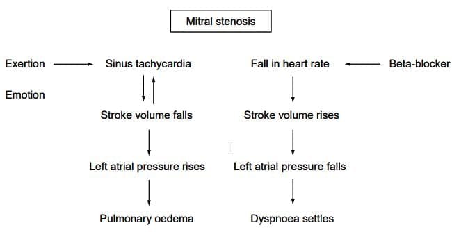 Rheumatic Heart Disease