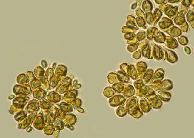 Kingdom Protista: Chrysophytes and Dinoflagellates | Biology Class 11 - NEET