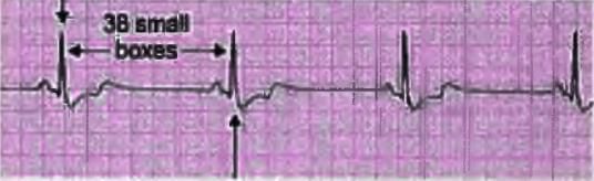Cardiology Chapter Notes | Medicine - NEET PG