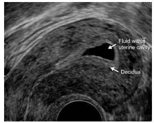 Biochemical measurements