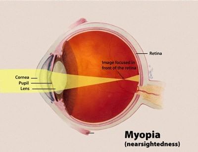 Cheat Sheet: The Human Eye and the Colourful World | Science Class 10