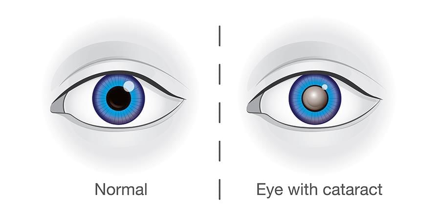 Cheat Sheet: The Human Eye and the Colourful World | Science Class 10