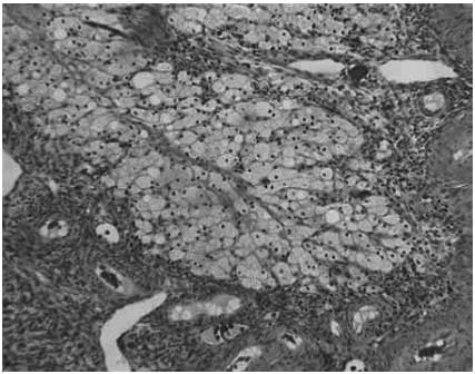 Folliculogenesis and the `Follicular Phase`