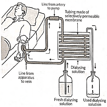 Class 10 Science Chapter 5 Previous Year Questions - Life Processes