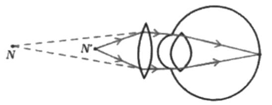 Class 10 Science Chapter 5 Previous Year Questions - Life Processes