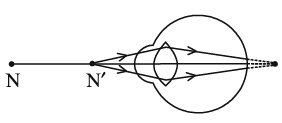 Class 10 Science Chapter 10 Previous Year Questions - The Human Eye and the Colourful World