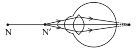 Class 10 Science Chapter 5 Previous Year Questions - Life Processes