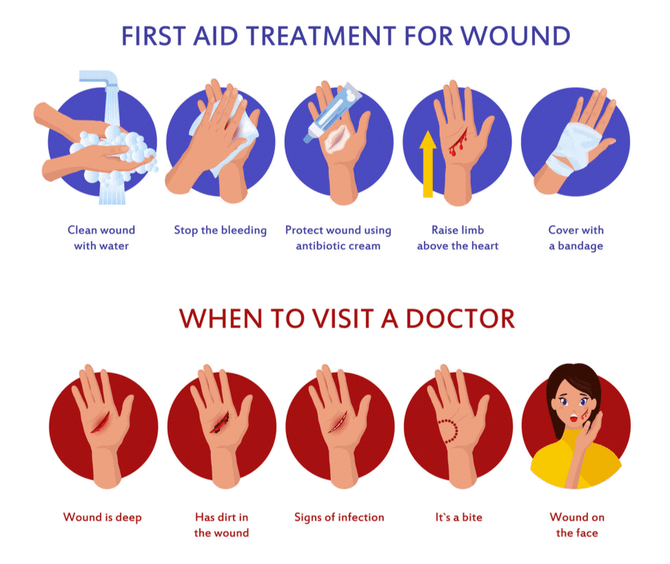 Safety and First Aid - 1 Class 5 Notes Science