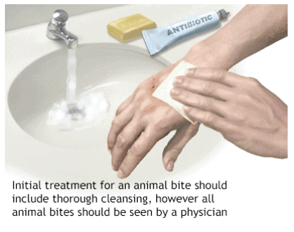 Safety and First Aid - 1 Class 5 Notes Science