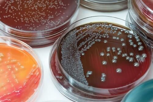 Culture Media & Methods, Identification of Bacteria by Conventional Chapter Notes | Microbiology - NEET PG