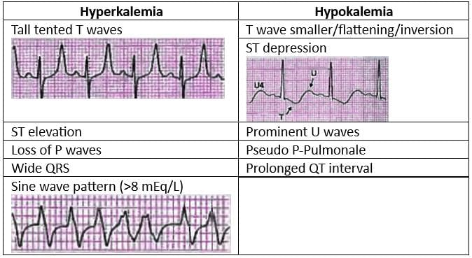 Cardiology Chapter Notes | Medicine - NEET PG