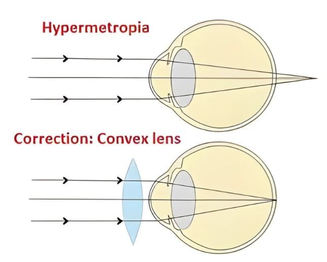 Cheat Sheet: The Human Eye and the Colourful World | Science Class 10