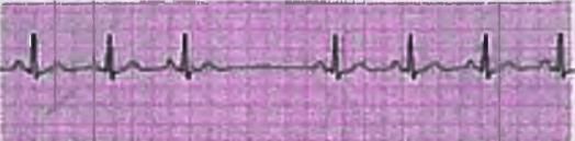 Cardiology Chapter Notes | Medicine - NEET PG