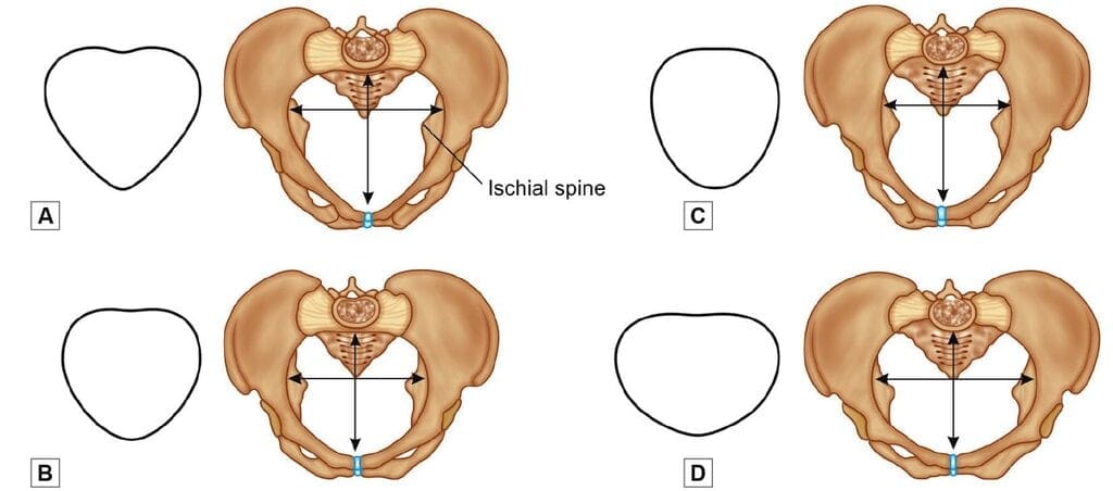 Types of female pelvises. A. Android; B. Gynecoid; C. Anthropoid; D. Platypelloid