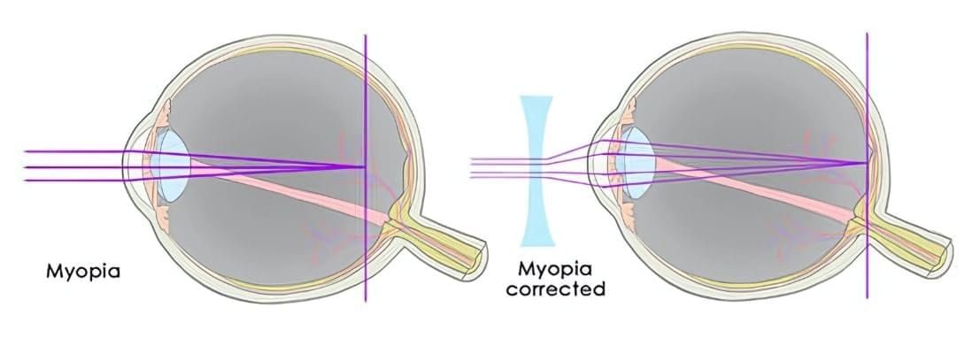 Cheat Sheet: The Human Eye and the Colourful World | Science Class 10