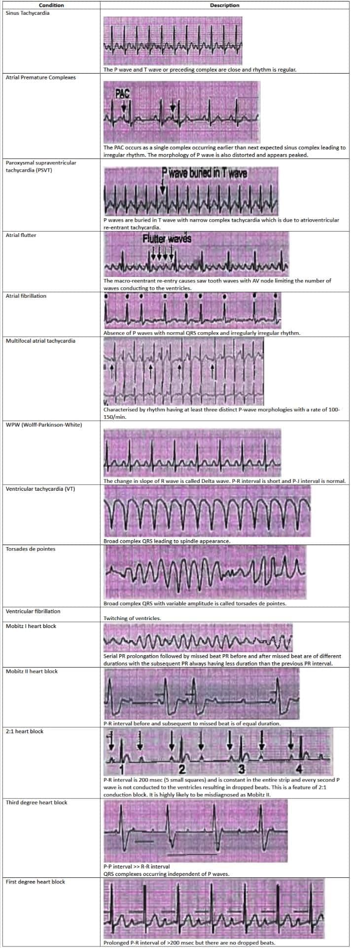 Cardiology Chapter Notes | Medicine - NEET PG