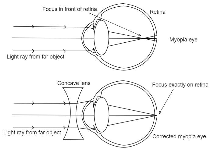 Class 10 Science Chapter 10 Previous Year Questions - The Human Eye and the Colourful World