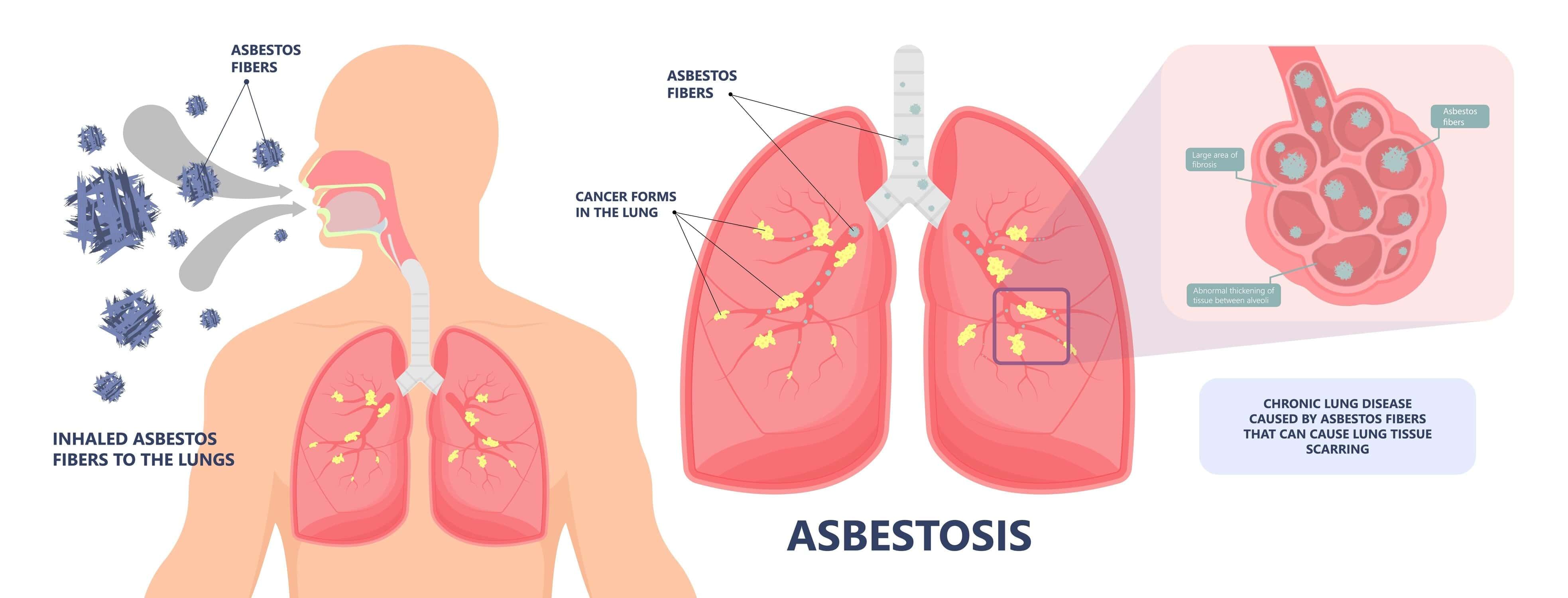 Important Diagrams: Breathing and Exchange of gases | Biology Class 11 - NEET