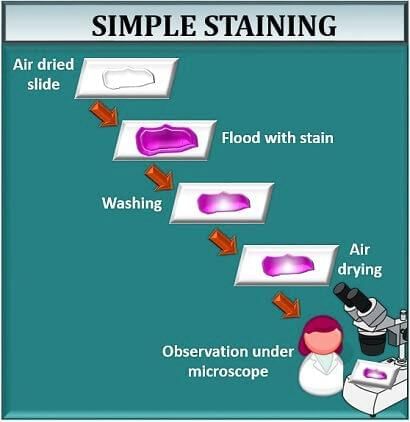 History, Taxonomy, Morphology and Physiology of Bacteria and Microbial Pathogenicity Chapter Notes | Microbiology - NEET PG
