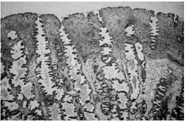 Folliculogenesis and the `Follicular Phase`