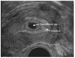 Biochemical measurements